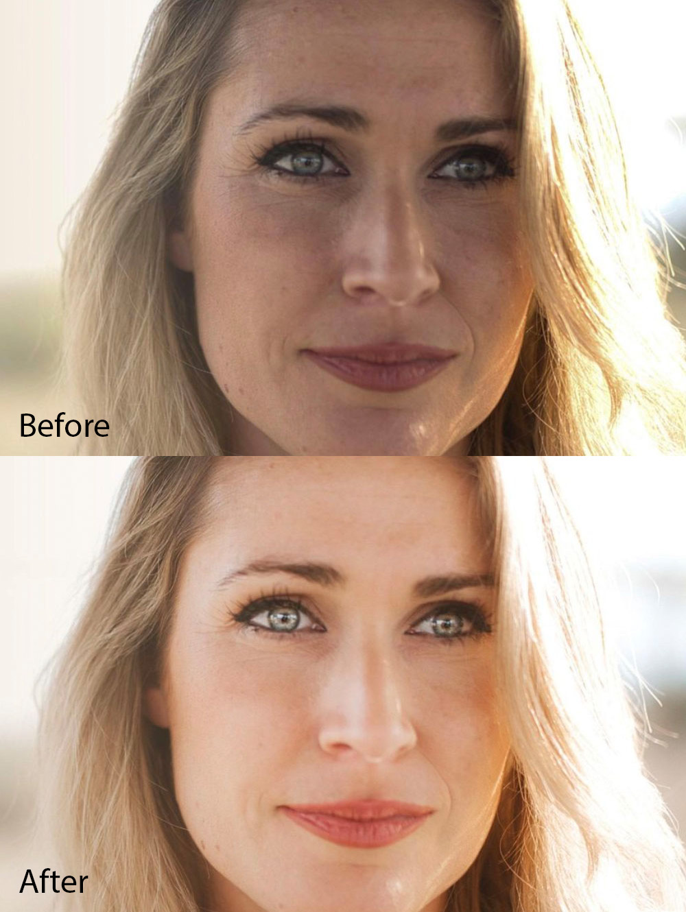 luminar skin ai before and after